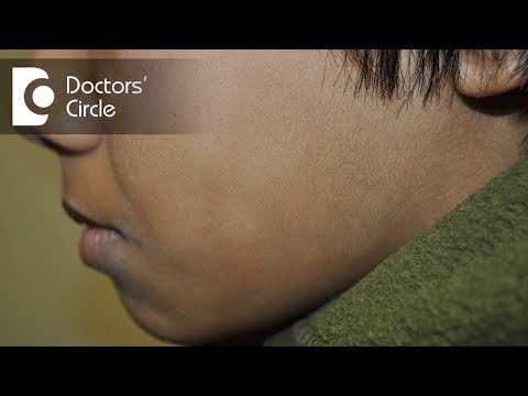 How to cure white patches on face in a young individual? - Dr. Rasya Dixit