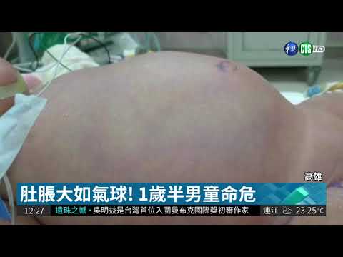 染綠膿桿菌 童開12次刀切腸保命