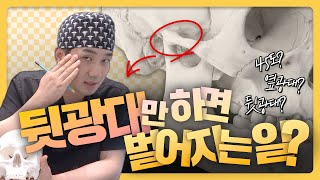 광대는 한 부위만 하면 안 됩니다 (45도·옆광대·뒷광 구조 설명)ㅣ비티성형외과