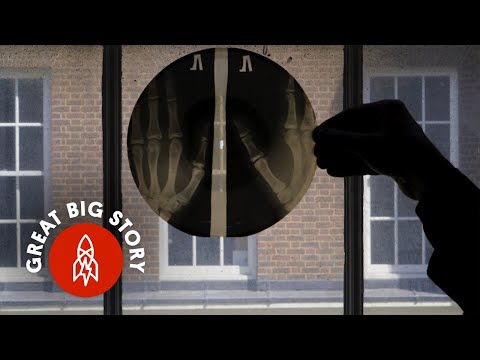 The Strange History of Soviet X-Ray Records