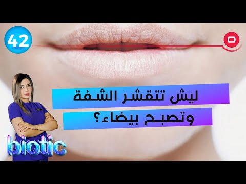 شاهد بالفيديو.. ليش تتقشر الشفة وتصبح بيضاء؟ -  م٢ Biotic  - الحلقة ٤٢