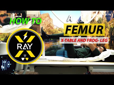 HOW TO X-RAY a FEMUR | routine | trauma | frog leg | cross table | danelius miller | rad tech