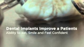 preview picture of video 'Dental Implants Denver Patients Depend On | (303) 493-1933'