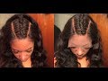 How Bleach My Knots On My 13x6 Frontal March Queen Hair Part 1
