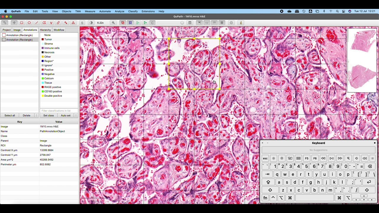 Creating annotations in Qupath