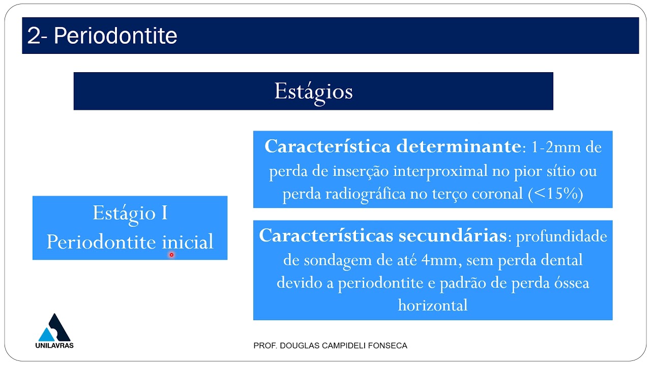 Classificação das doenças periodontais - Periodontite