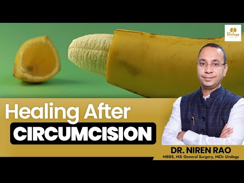 Healing Process after Circumcision (हिंदी में) | Circumcision Procedure | Delhi Urology Hospital