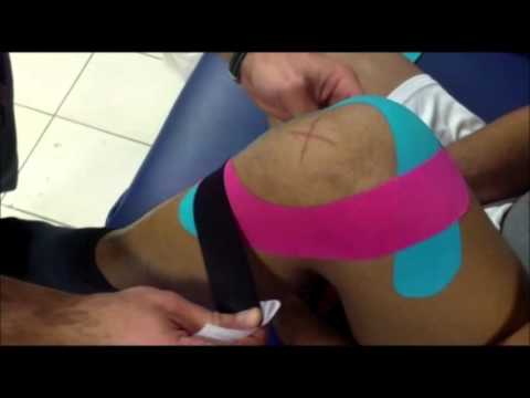 Crackle articolazioni una ragazza di 13 anni Dolore al torace nel mezzo di osteocondrosi