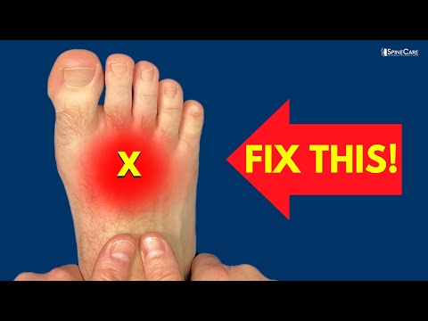 How to Fix Pain on the TOP of the Foot