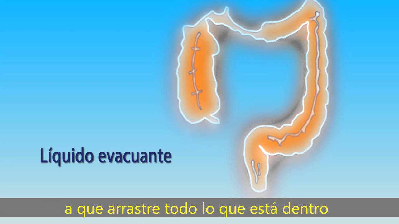 V&iacute;deo sobre preparaci&oacute;n para una colonoscopia.