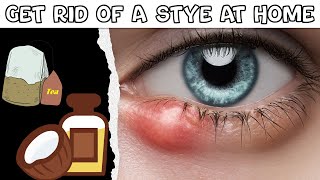 How To Get Rid Of A Stye At Home |Natural Remedies For Stye |Best Ways To Get Rid Of A Stye Easily
