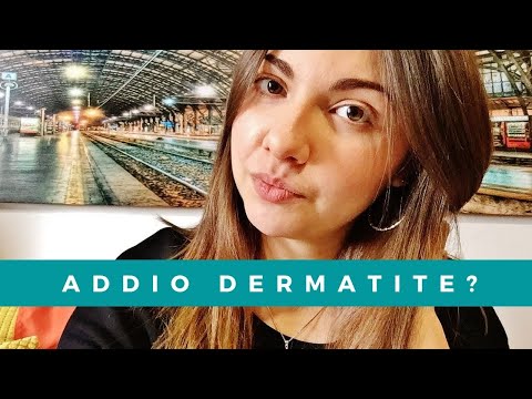 Psoriasi di malattia di YouTube Eczema di mani allatto di nutrizione