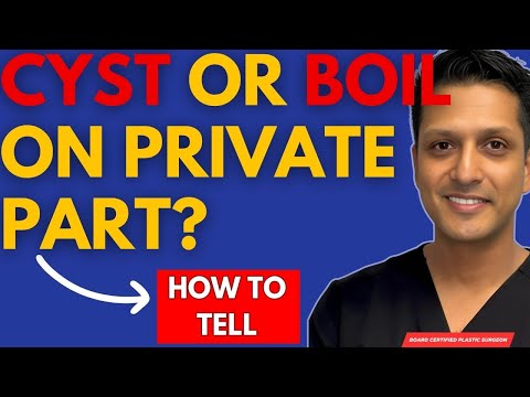 Is It A Cyst Or Boil? (bumps on the private area explained)