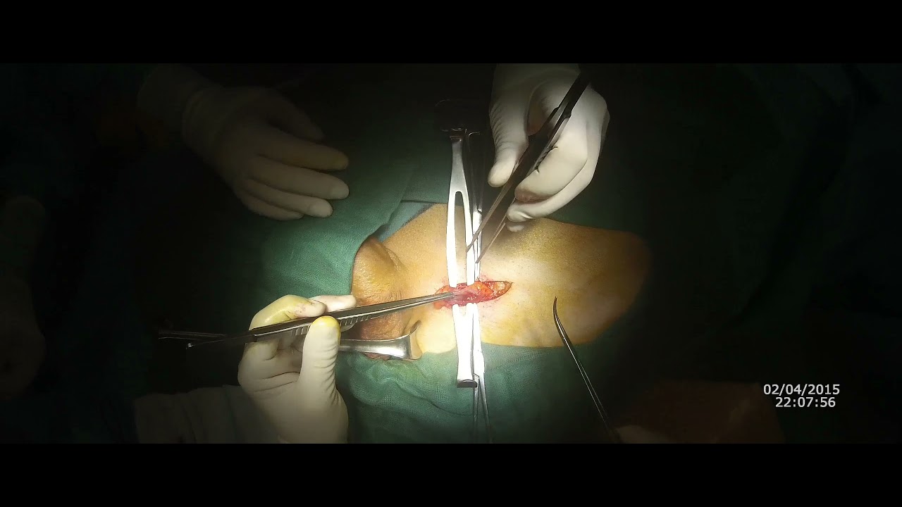 Pier Andrea Della Camera-86