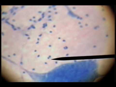 Slide 41 - Giant Mulitpolar Neuron