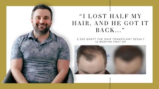 Canadian Hair Transplant Centre