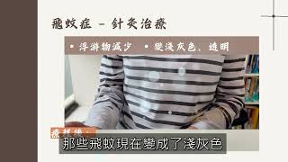 飛蚊症 — 針灸治療