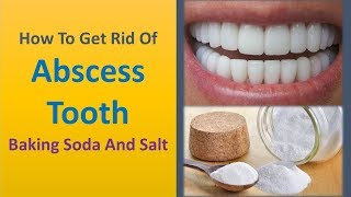 how to get rid of abscess tooth - Baking Soda and Salt