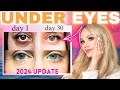 2024 Best Under Eye Treatments Dark Circles Eye Bags Wrinkles More