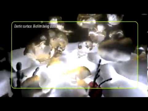 Henry Schein UK - Hu-Friedy SWERV3