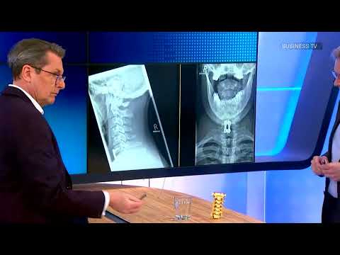 Instabilität der Halswirbelsäule