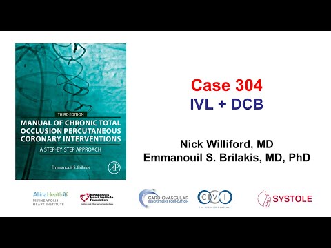 Case 304: Manual of CTO PCI -  IVL + DCB