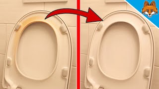 How to remove YELLOW STAINS from toilet seat ⚡️ Get toilet seat WHITE again 💥