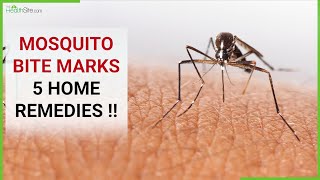 How To Get Rid Of Red Marks & Itch, Effective Home Remedies For Mosquito Bite !!