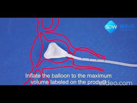 Balloon Uterine Stent