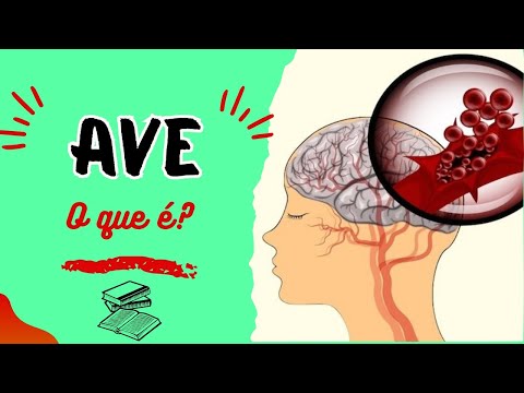 AVE ( ACIDENTE VASCULAR  ENCEFÁLICO), O QUE É?