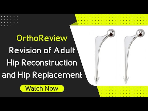 OrthoReview - Revision of Adult Hip Reconstruction and Hip Replacement for Orthopaedic Exams