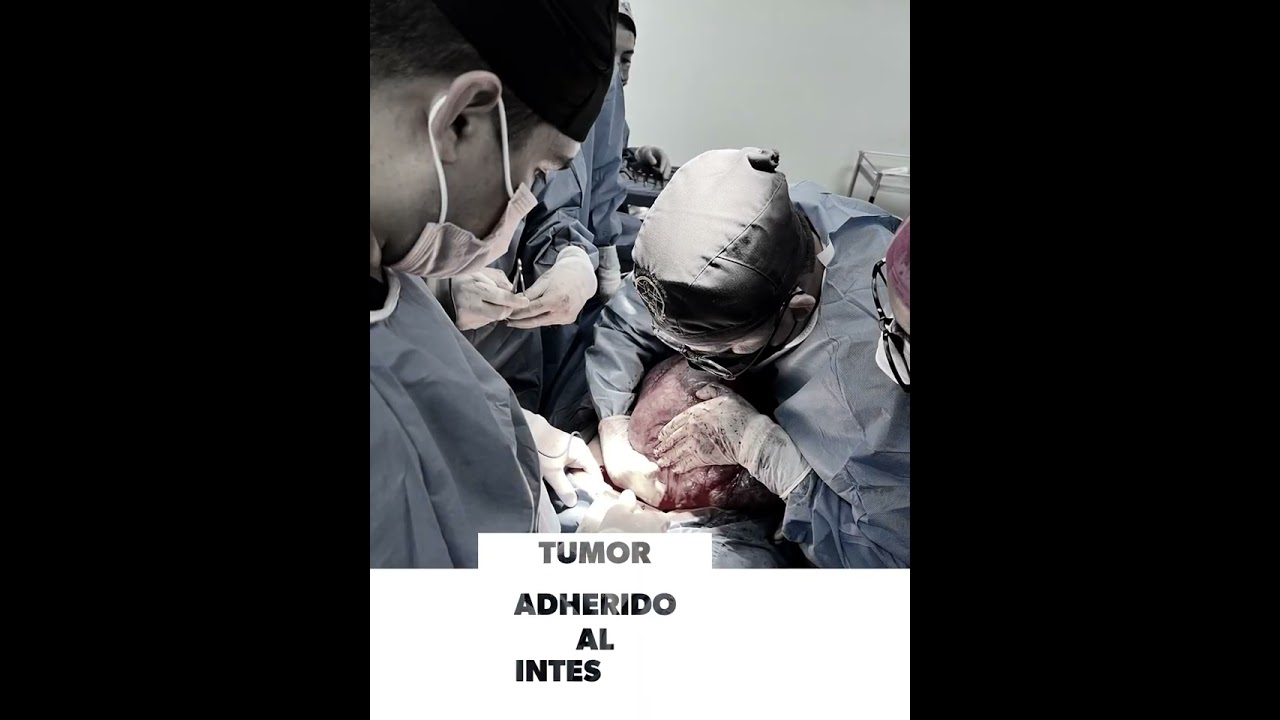 Ángel Millán Juárez-85