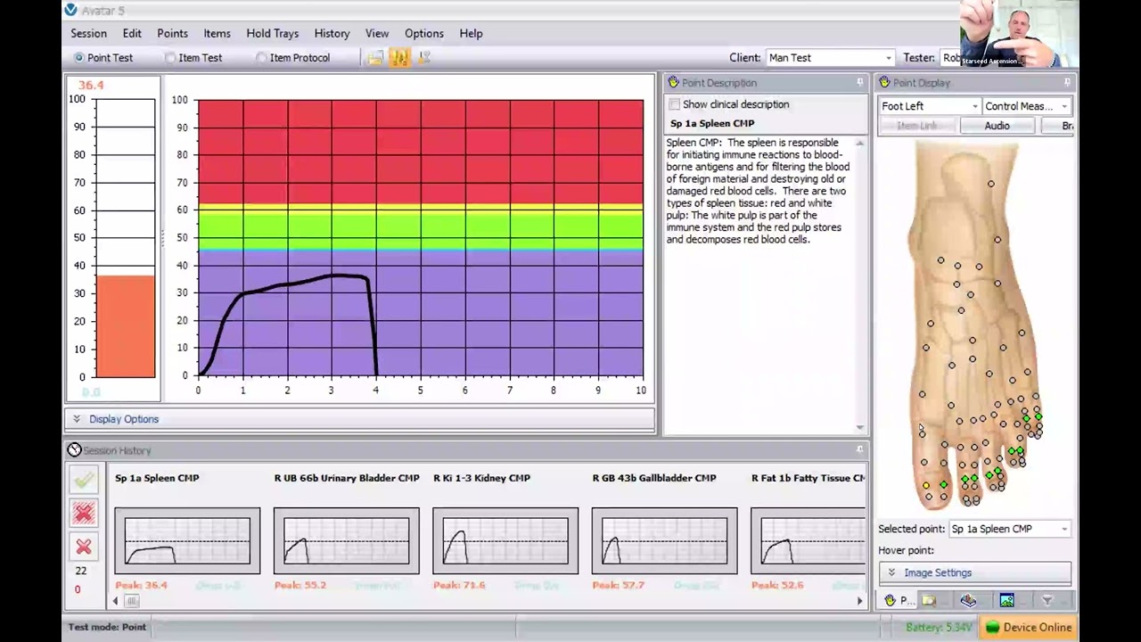 What is an EAV Machine