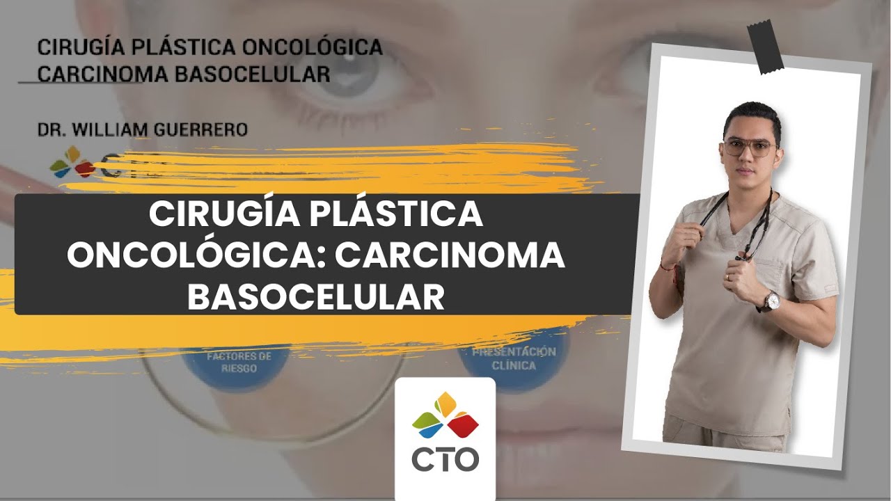 Cirugía Plástica Oncológica   Carcinoma Basocelular
