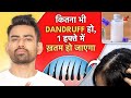 Dandruff का Permanent Solution At Home For Men Women