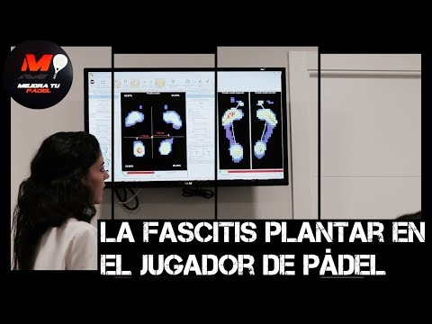 La Fascitis plantar en el jugador de pádel