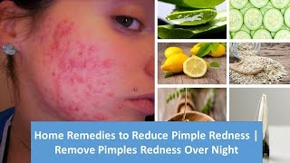 Home Remedies to Reduce Pimple Redness | Remove Pimples Redness Over Night
