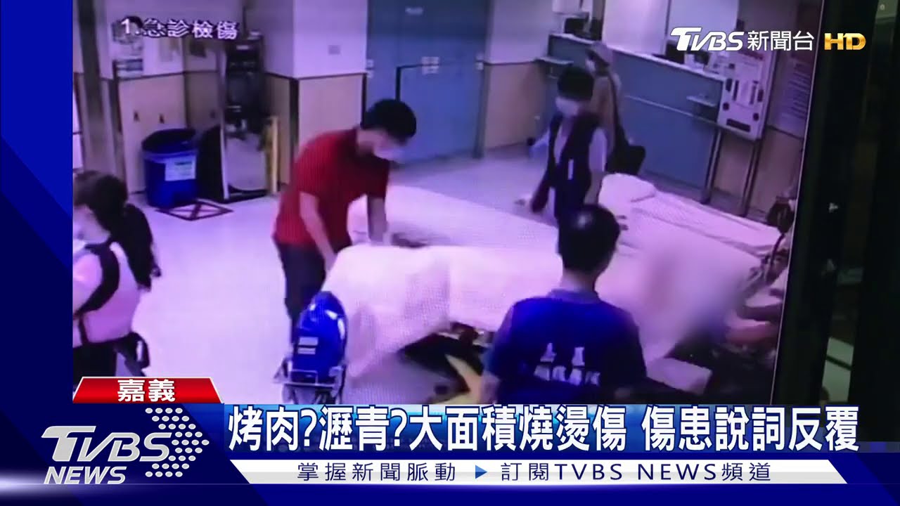 怎弄的？疑烤肉遭燙傷　2男送醫插管搶救