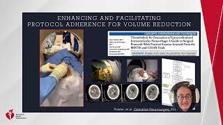 Strategies for ICH: A Review of Specialized Techniques