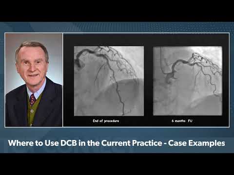 Sirolimus-Coated Balloons | Clinical Updates and Potential Advantages | TCT Connect 2020 Symposium