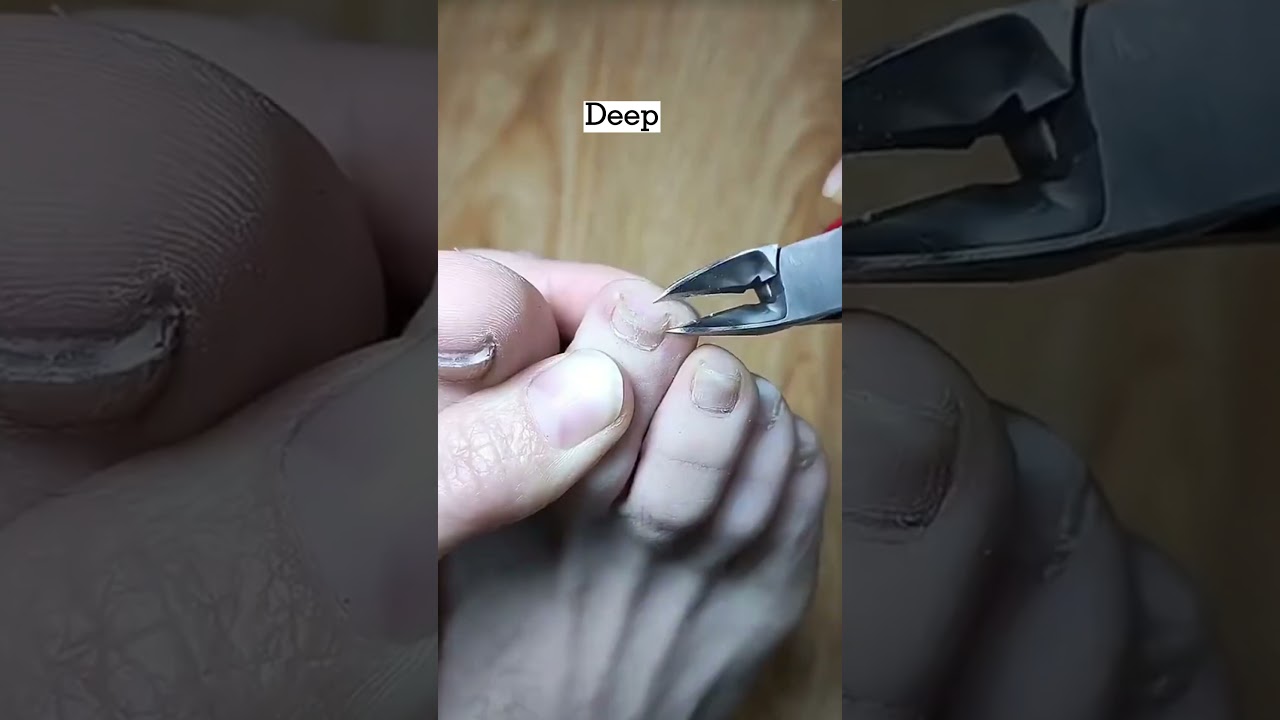 Ingrown Nails?🦶 Try This Big Guy!😝✂️