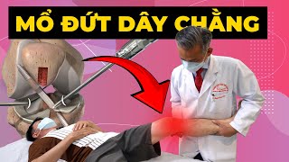 UNSITABLE FOR STANDING AND SITTING DUE TO A RUPTURED CRUCIATE LIGAMENT - THE RIGHT TREATMENT SOLU...
