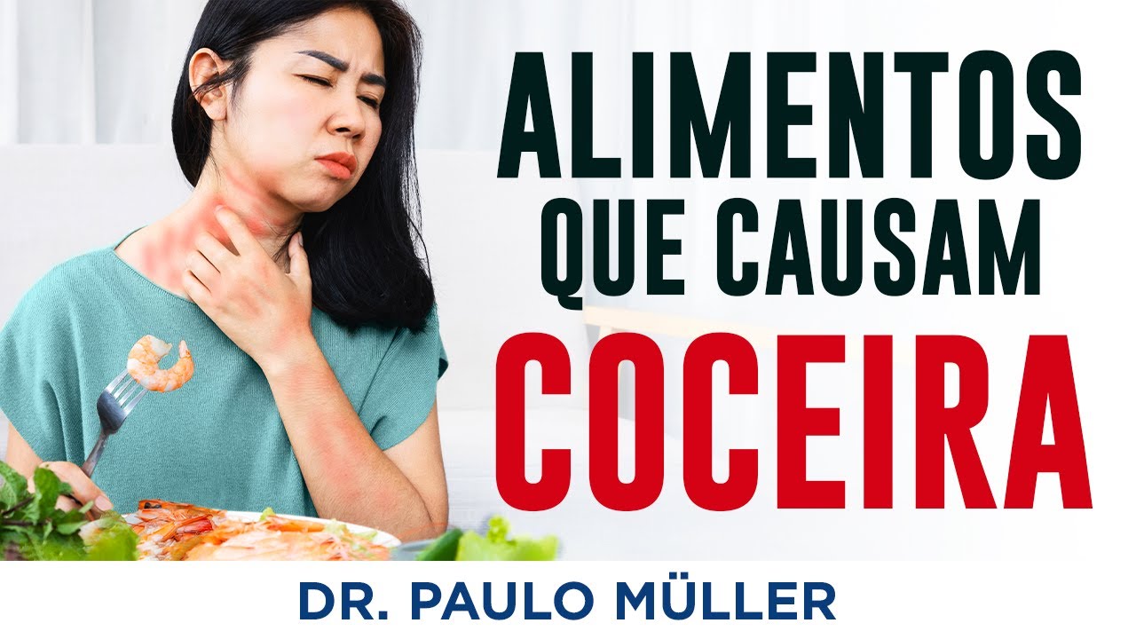 Alimentos Que Causam Coceira e Urticária - Dr. Paulo Müller Dermatologista.