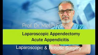 Miniaturka - Laparoscopic Appendectomy. Acute Appendicitis. Metin Ertem MD.FACS