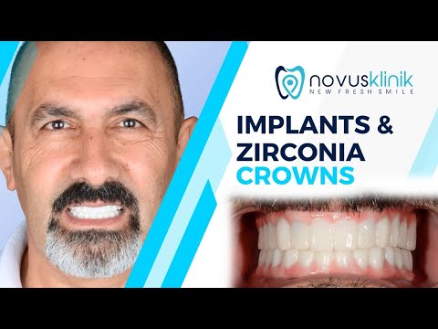 Logo of Painless Complete Dental Implants in Istanbul, Turkey – Top Clinics and Methods