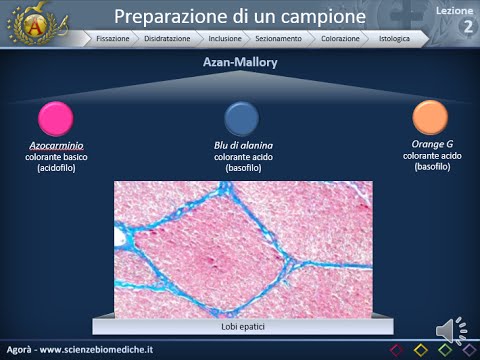Mal di schiena nella zona dei reni durante la gravidanza Perché torce giunti a gambe notte