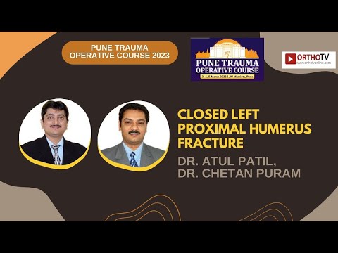 PTOC 2023 : CLOSED LEFT PROXIMAL HUMERUS FRACTURE - DR. ATUL PATIL, DR. CHETAN PURAM