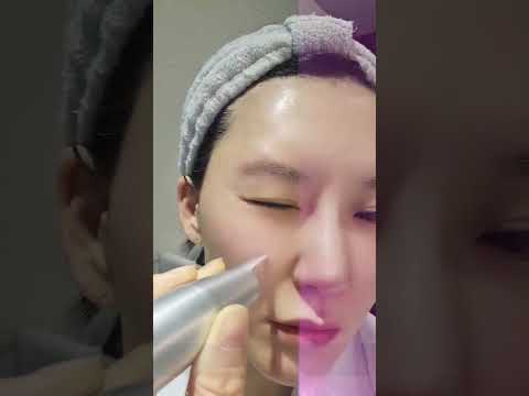 원장 셀프 토닝 영상 썸네일
