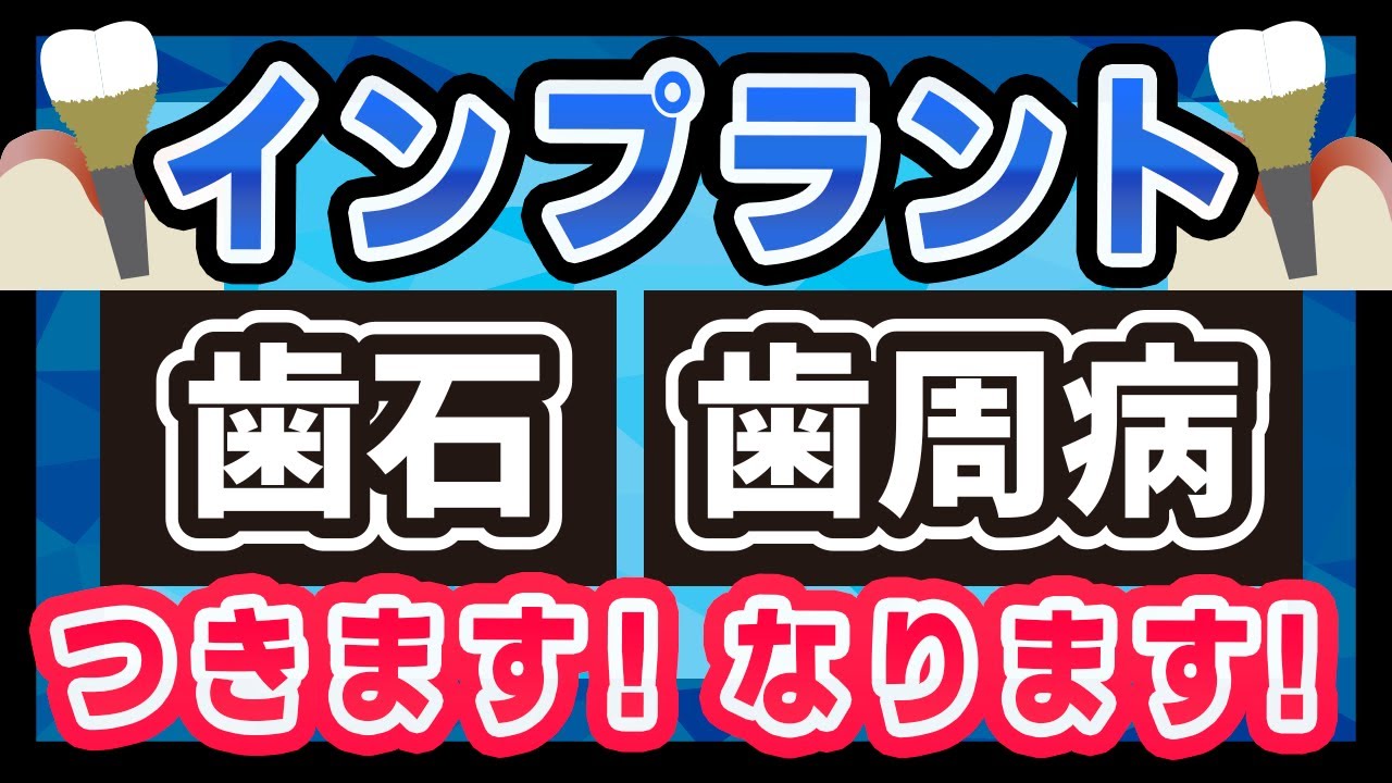 インプラントはむし歯にならない?【インプラント周囲炎】