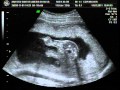 It S A Baby Boy
